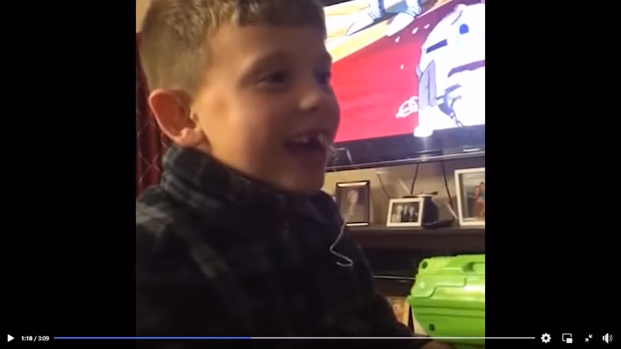 Clip: 1001 cách nhổ răng sữa khiến nha sĩ phải lắc đầu