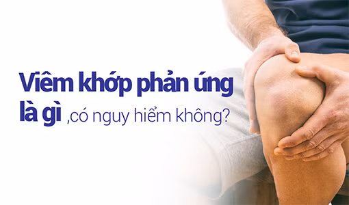 Viêm khớp phản ứng có thể gây ra biến chứng viêm cột sống dính khớp