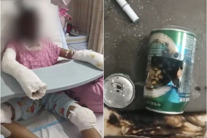 Một bé gái thiệt mạng, một bé bị thương nặng vì bắt chước làm bỏng ngô tại nhà. Ảnh: AO.