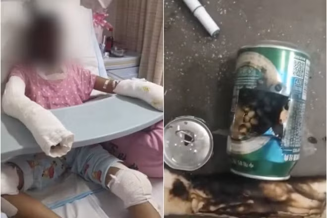 Một bé gái thiệt mạng, một bé bị thương nặng vì bắt chước làm bỏng ngô tại nhà. Ảnh: AO.