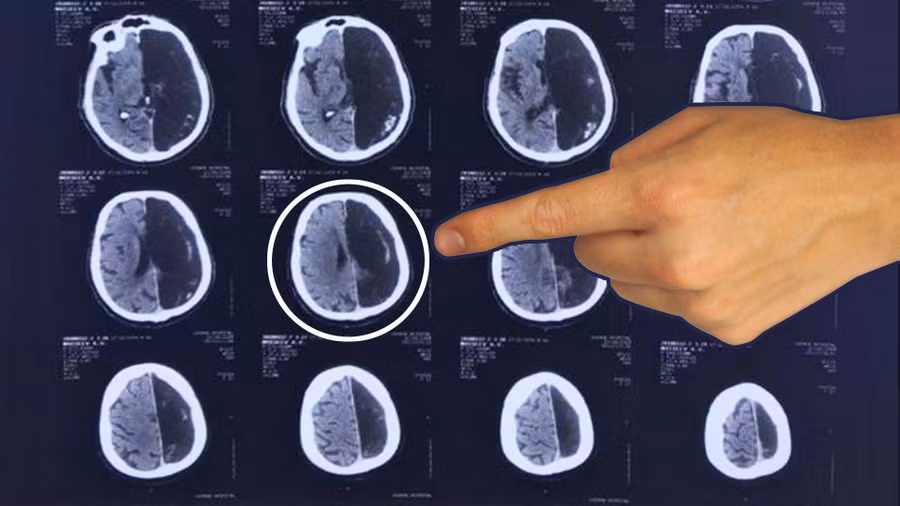 Hình ảnh chụp não của bệnh nhân.