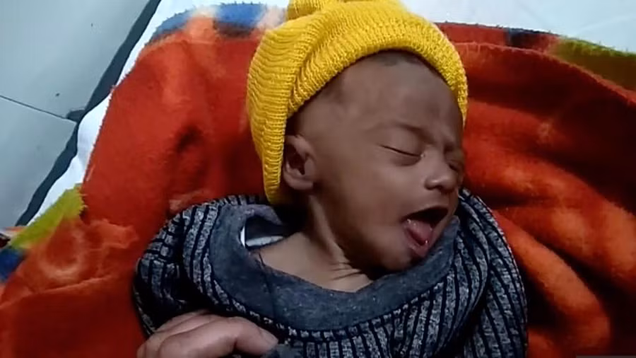 Bị chôn sống dưới cái lạnh 3 độ C, bé gái 3 tuần tuổi sống sót kỳ diệu