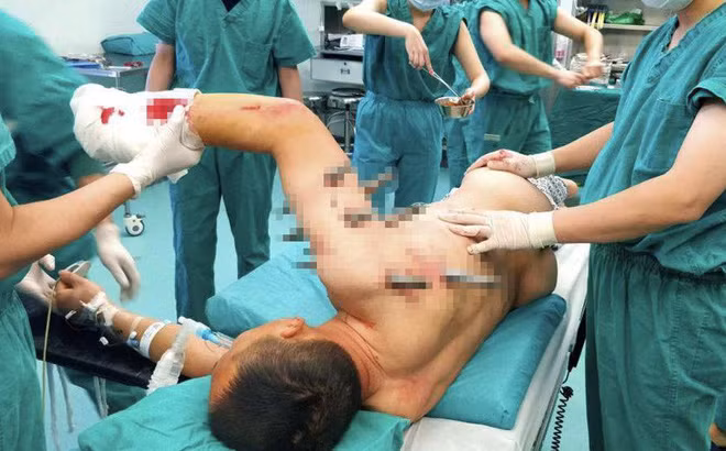 10 chiếc đinh thép khổng lồ có kích thước dài 30 cm và dày 1,5 cm khiến ông Zhou không thể cử động cánh tay phải.