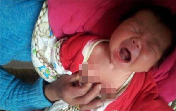 4 bộ phận của trẻ sơ sinh cha mẹ không nên chạm vào, sẽ nguy hại cho bé ảnh 2 4 bo phan cua tre so sinh cha me khong nen cham vao, bang khong nguy hai cho be - 2