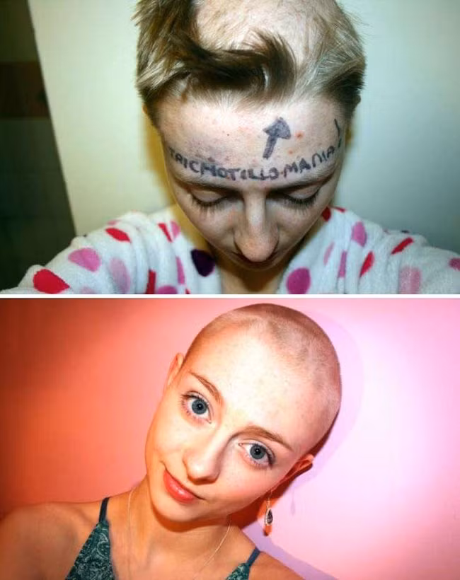 nhung chung benh hiem gap nhat tren the gioi hinh anh 11