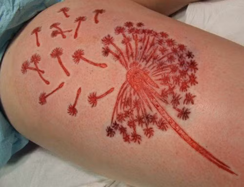 Rợn người kiểu xăm “đục da khoét thịt” của giới trẻ ảnh 3