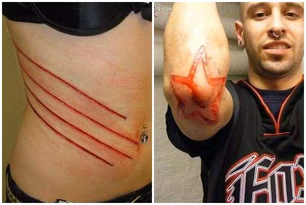 Rợn người kiểu xăm “đục da khoét thịt” của giới trẻ ảnh 7