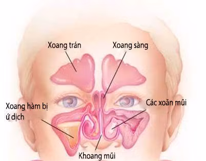Phòng viêm mũi xoang lúc chuyển mùa