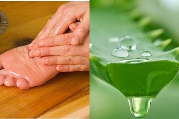 Điều trị gót chân bị nứt nẻ hiệu quả với gel nha đam