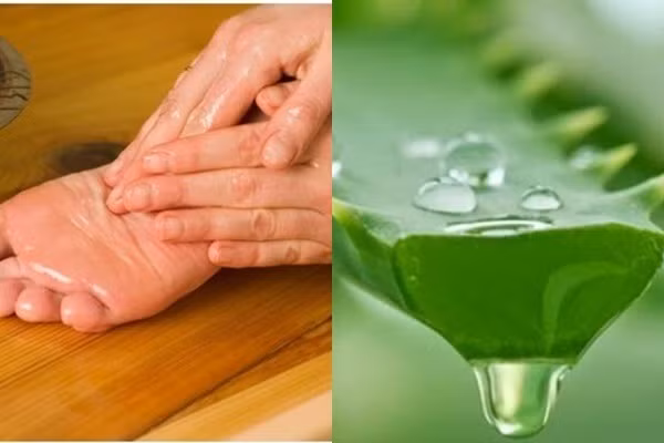 Điều trị gót chân bị nứt nẻ hiệu quả với gel nha đam