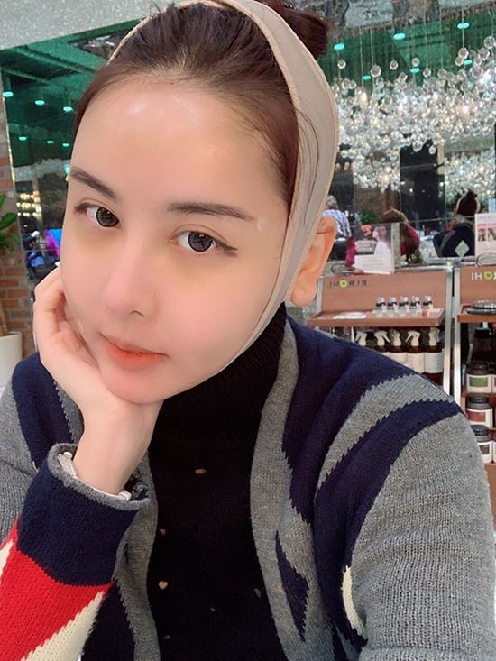 Phẫu thuật quá khác, mẹ hot girl Hà Lade phải thốt lên: "Chả phải con mình" hình ảnh 2 phau thuat qua khac, me hot girl ha lade phai thot len: "cha phai con minh" hinh anh 2