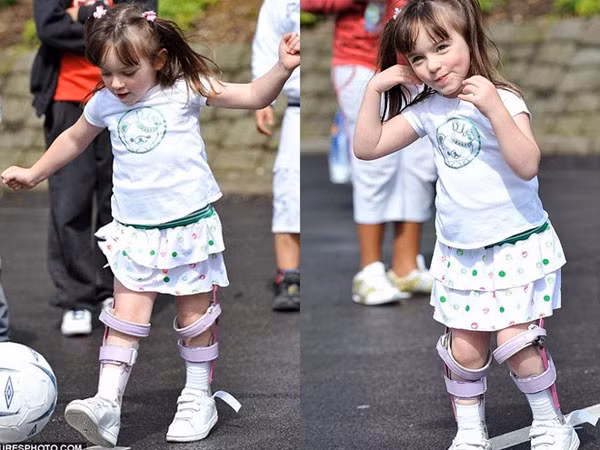 Cô bé suýt chết thành người mẫu nhí và phép màu của nỗ lực