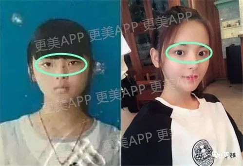 "Cô gái đẹp nhất Trung Quốc" bất ngờ lộ mặt nguyên bản xấu xí hình ảnh 2 "co gai dep nhat trung quoc" bat ngo lo mat nguyen ban xau xi hinh anh 2