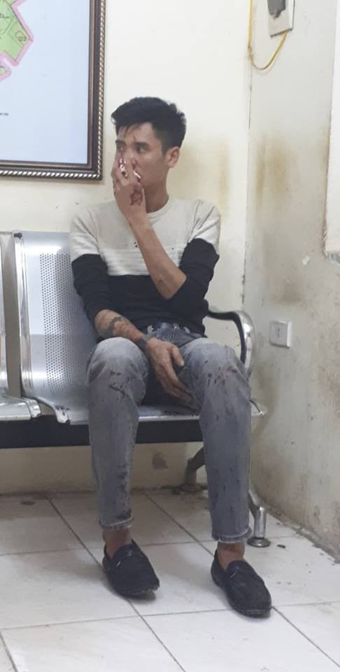 Bị hại là anh Nguyễn Xuân Vĩnh bị nhóm đối tượng đánh gãy sống mũi 47149174_436077703594315_8470021527457234944_n