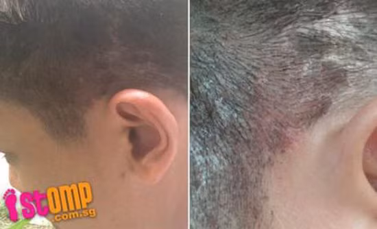 Tự tẩy tóc tại nhà để tiết kiệm tiền, cô gái rước họa vào thân - Ảnh 4