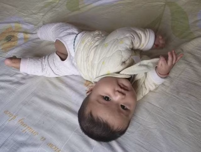 Tưởng con 3 tháng đã biết đứng là phát triển vượt trội, bố mẹ không ngờ bé mắc bệnh nặng 