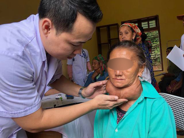 Các bác sĩ phát hiện người phụ nữ có khối u khổng lồ trong đợt khám tình nguyện tại Sơn La