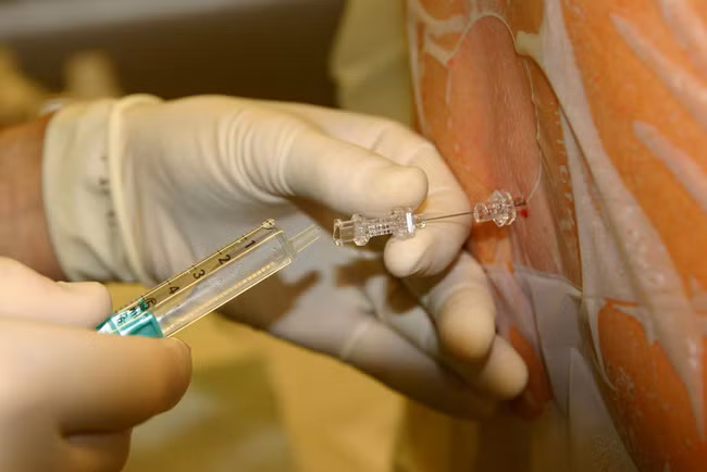 Clip: Chứng kiến quá trình gây tê tủy sống trước khi sinh mổ, chị em bảo nhau: “Thôi cố gắng đẻ thường!” - Ảnh 4.