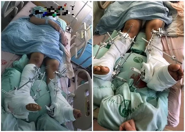 Nam sinh đang được điều trị tại bệnh viện.