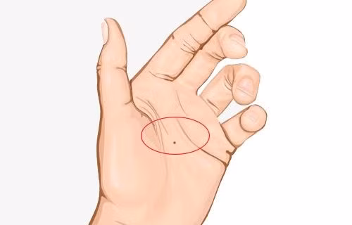 4------------------Danh-sach-4-not-ruoi-khai-va