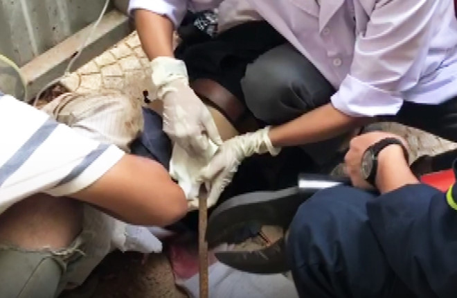 Đà Nẵng: Thanh sắt rơi từ công trình xây dựng đâm thủng bụng công nhân ảnh 1 Thanh sat roi tu cong trinh xay dung dam thung bung cong nhan hinh anh 2