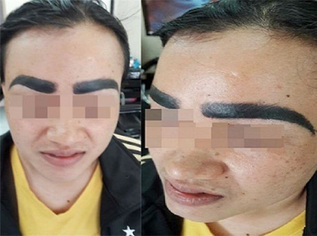 Thảm họa phun xăm lông mày khiến dân mạng cười chảy nước mắt ảnh 3 Thảm họa phun xăm lông mày khiến dân mạng cười chảy nước mắt ảnh 3