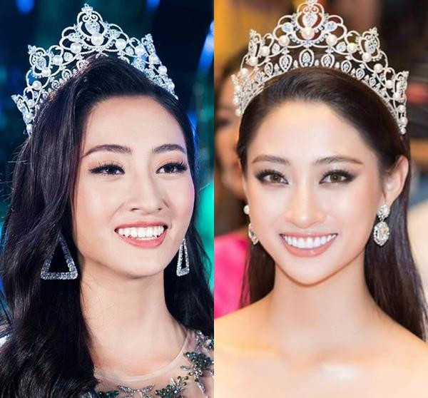 Rộ tin đồn hoa hậu Lương Thùy Linh làm lại răng sau 1 tháng đăng quang Miss World Vietnam-1