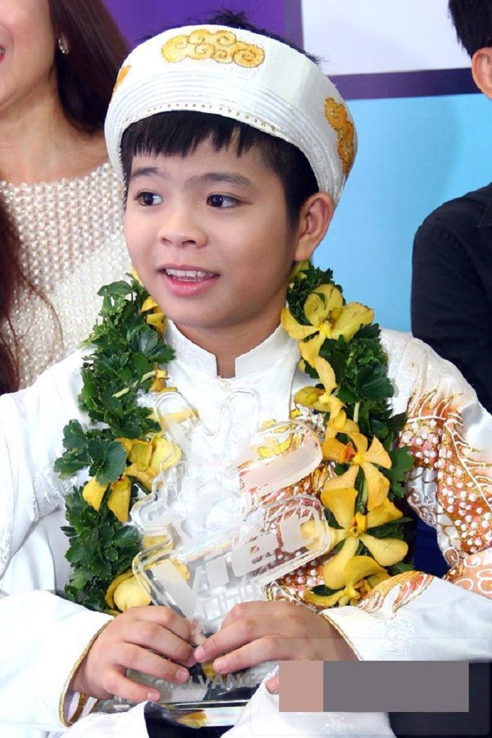 Sau khi phẫu thuật thẩm mỹ, quán quân "The Voice Kids" Quang Anh thay đổi thế nào? ảnh 1 Sau khi phẫu thuật thẩm mỹ, quán quân "The Voice Kids" Quang Anh thay đổi thế nào? ảnh 1