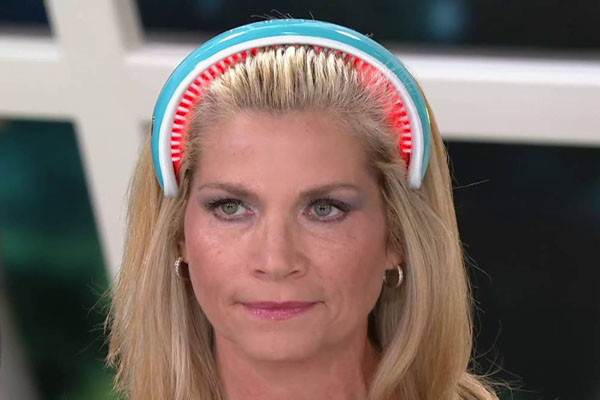 Những răng lược giữ thiết bịcố định trên da đầu cho phép tia laser chiếu trực tiếp vào các nang tóc. Ảnh: YT