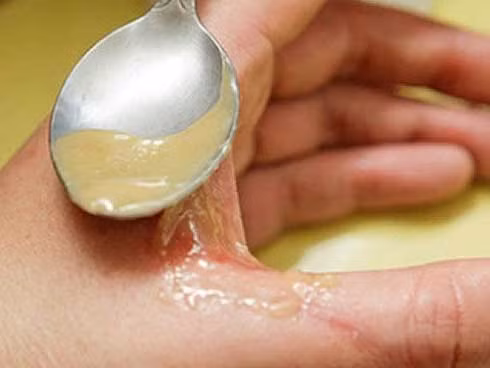 Nhà ai cũng có lọ mật ong nhưng ít người biết tận dụng hết 15 lợi ích tuyệt vời