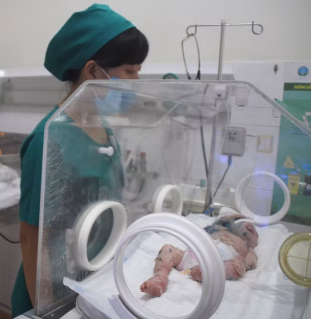 Bé N.H.H. đang được tích cực điều trị tại Bệnh viện Nhi đồng Đồng Nai.