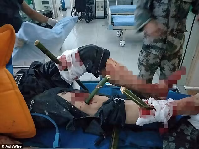 Nạn nhân bị 10 thanh tre đâm thủng người