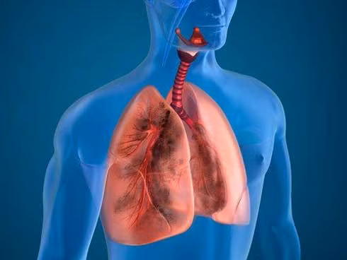 10 cách giúp thanh lọc phổi tự nhiên hiệu quả