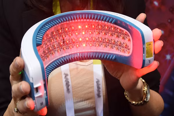 Ánh sáng laser trị liệu có tác dụng kích thích mọc tóc và tránh được nguy cơ rụng tóc. Ảnh: BL