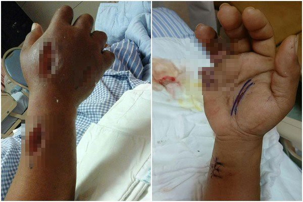 2 người phụ nữ tử vong sau khi ăn hải sản: Hãy cẩn trọng và đừng bao giờ ăn hải sản kiểu này - Ảnh 3. 2 người phụ nữ tử vong sau khi ăn hải sản: Hãy cẩn trọng và đừng bao giờ ăn hải sản kiểu này - Ảnh 3.