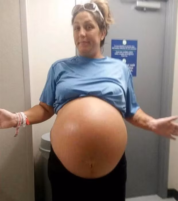  Nhìn bụng bầu của Chrissy, không ai ngạc nhiên khi cô hạ sinh một em bé ngoại cỡ. 