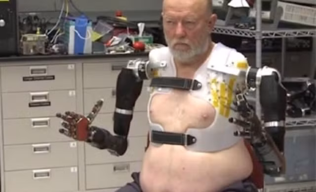 Người đàn ông cụt cả 2 tay dùng ý nghĩ điều khiển chi giả