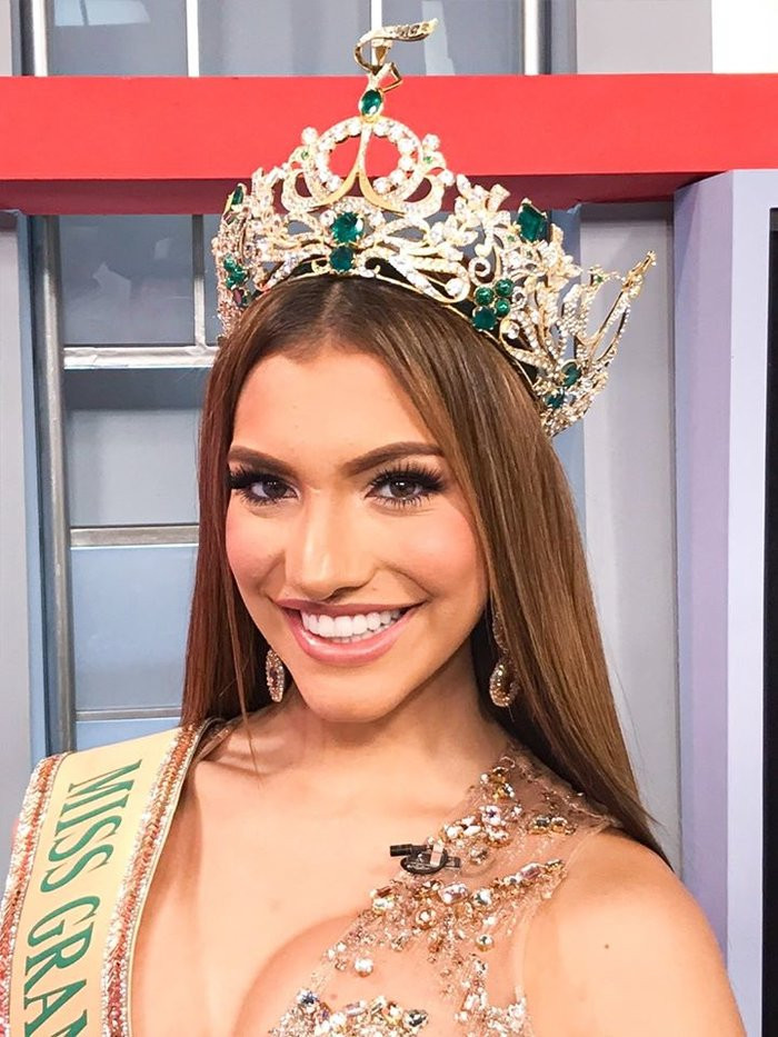 Trên sóng mũi phải của Valentina Figuerm cũng có vết thẹo giống với Á hậu Hoàng Thùy.