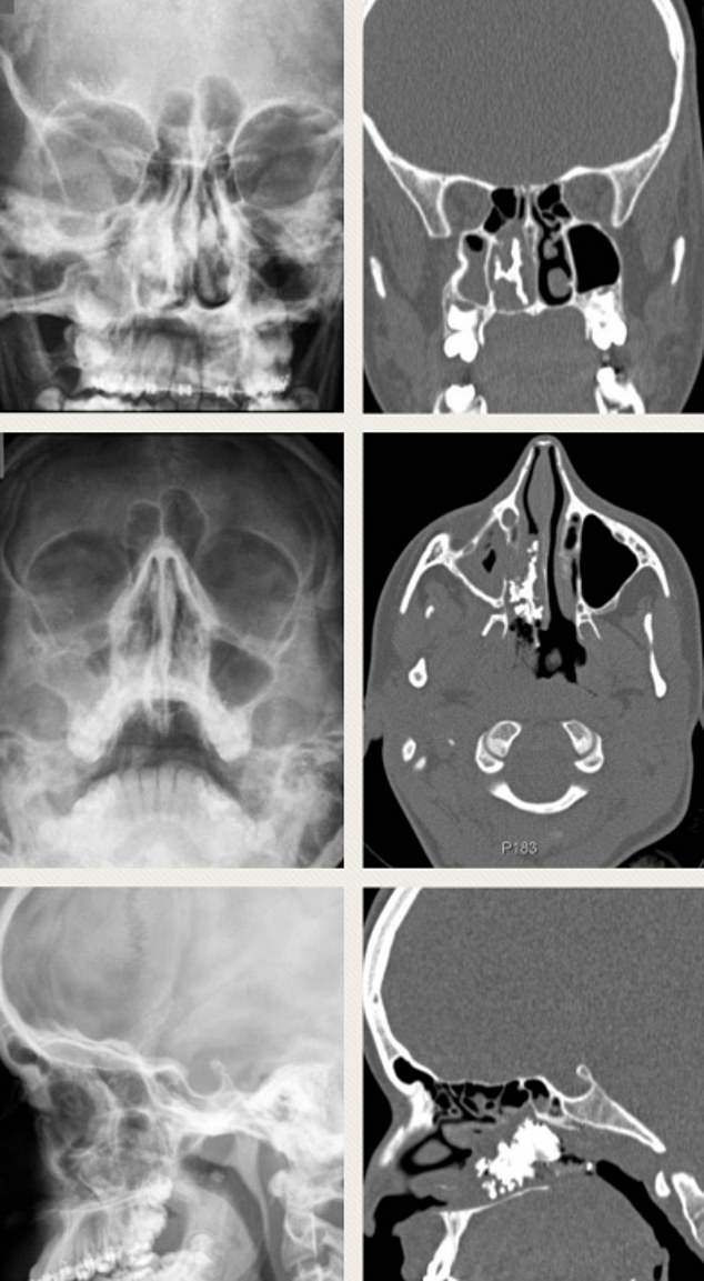 bi chay mau mui khong ro nguyen nhan, 10 nam sau co gai moi tim ra su that hai hung - 3