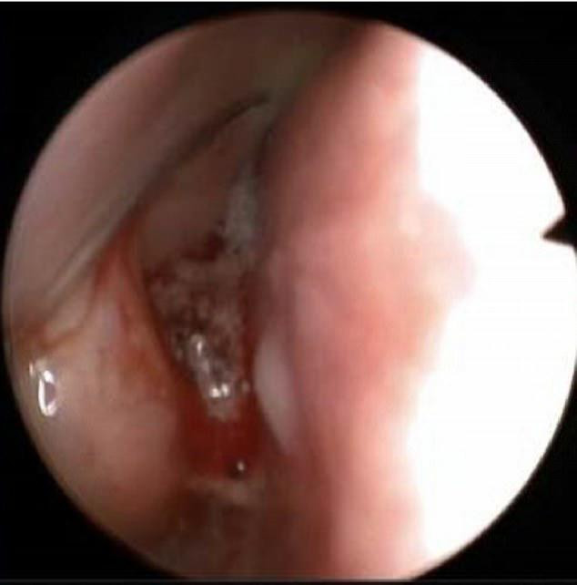 bi chay mau mui khong ro nguyen nhan, 10 nam sau co gai moi tim ra su that hai hung - 2