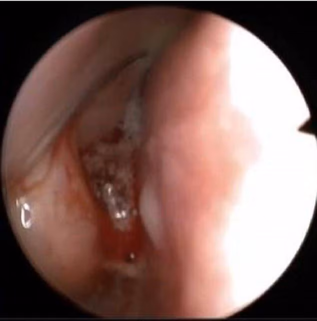 bi chay mau mui khong ro nguyen nhan, 10 nam sau co gai moi tim ra su that hai hung - 2