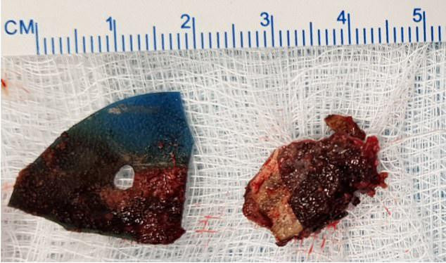 bi chay mau mui khong ro nguyen nhan, 10 nam sau co gai moi tim ra su that hai hung - 1