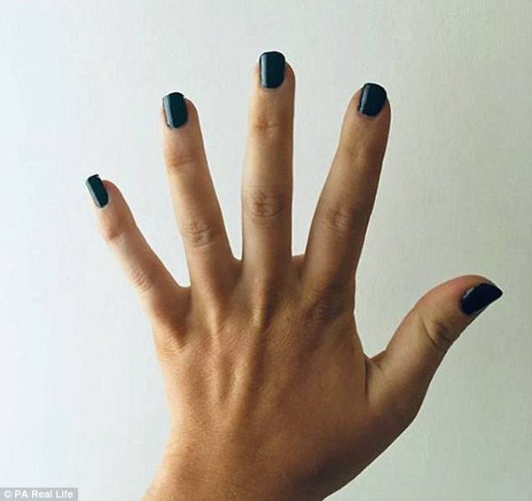 Người phụ nữ có bàn chân, bàn tay phát triển không ngừng Người phụ nữ có bàn chân, bàn tay phát triển không ngừng