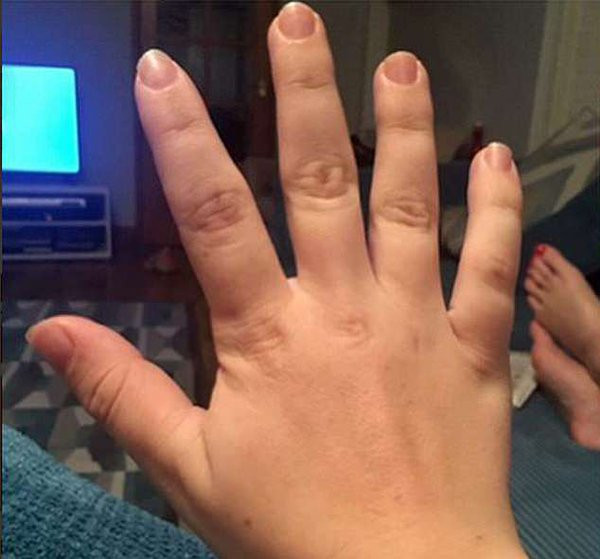 Người phụ nữ có bàn chân, bàn tay phát triển không ngừng Người phụ nữ có bàn chân, bàn tay phát triển không ngừng