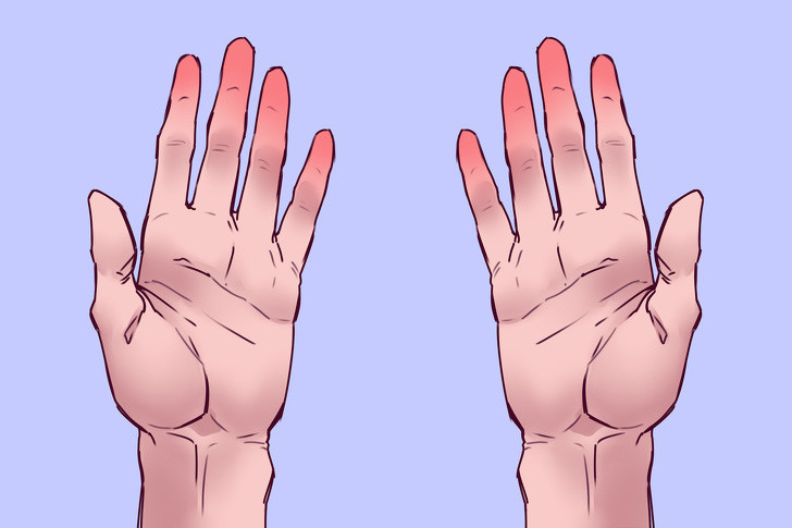 Dùng 1 túi đá trong 30s, bạn sẽ biết ngay tình hình sức khỏe tim mạch của mình và sớm phòng tránh đột quỵ - Ảnh 3.