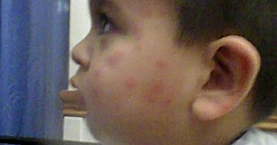 Nhận 1,6 triệu USD sau khi thắng kiện vì bị rệp cắn ảnh 1 Nhận 1,6 triệu USD sau khi thắng kiện vì bị rệp cắn ảnh 1