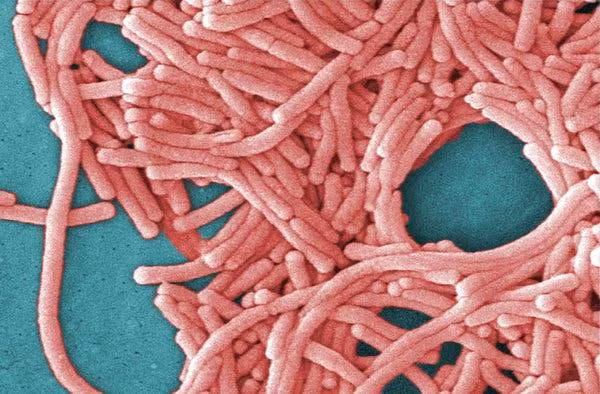 Legionnaires là bệnh viêm phổi do vi khuẩn Legionella gây ra. 