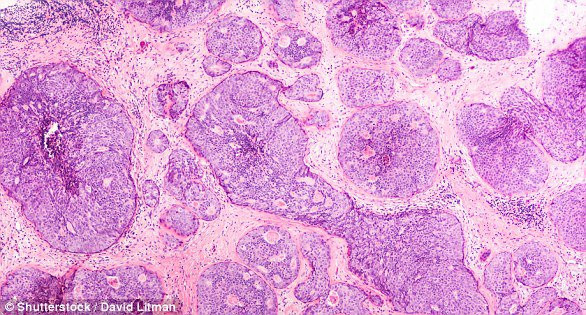 chuyen gia khang dinh an loai thit nay thuong xuyen giup ban tranh xa ung thu vu - 4