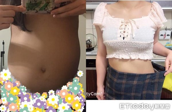 sieu am nhung khong thay buong trung, co gai tre bat ngo khi nhan duoc chan doan tu bac si - 3