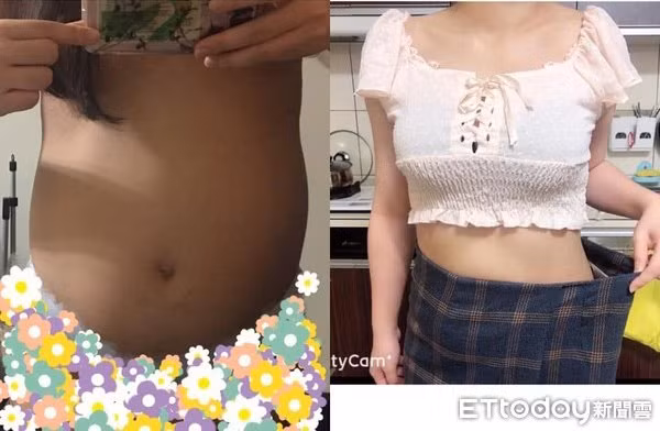 sieu am nhung khong thay buong trung, co gai tre bat ngo khi nhan duoc chan doan tu bac si - 3